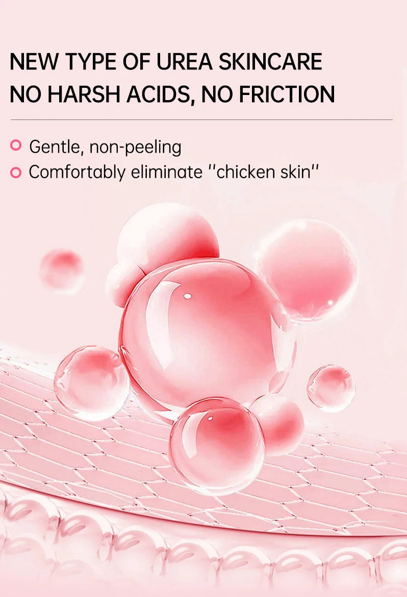 Chicken Skin Cream Keratosis Pilaris Treatment Chicken Remover