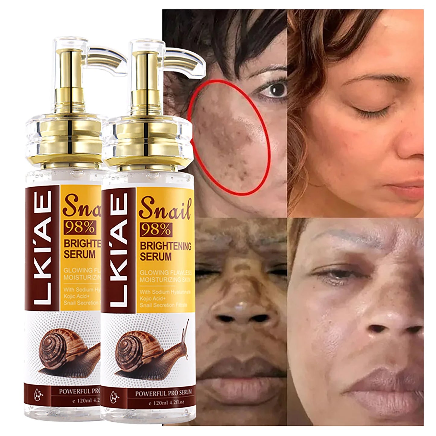 AILKE Dark Spot Eraser Vitamin K Snail Hyaluronic Acid